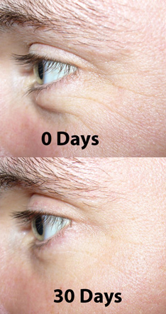 How Elite Serum Works