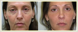 Before and After 1