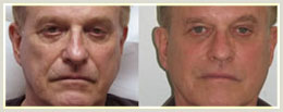 Before and After 2