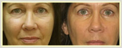 Before and After 3